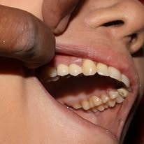 Dental Care